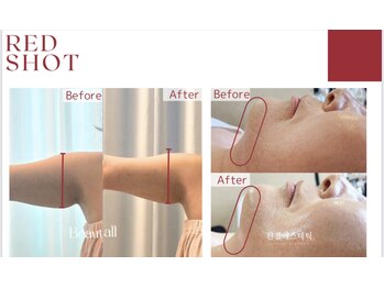 スプレール 水戸店/RED SHOT レッドショット