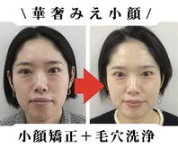 ブプラ 小田原店(BUPURA)