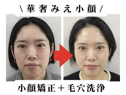 ブプラ 小田原店(BUPURA)の写真