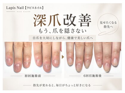 ラピスネイル(Lapis Nail)の写真