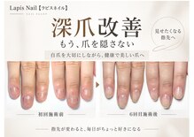 ラピスネイル(Lapis Nail)