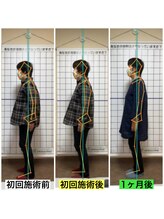 ニコラ(NICORA)/姿勢の変化前後