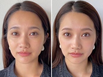 メイロ 名駅店(meiro)/before after