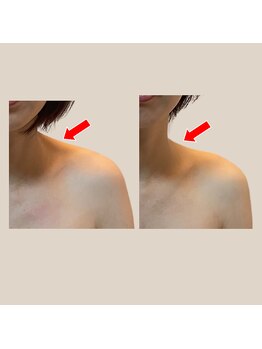 オルオル(.olu olu)/もっこり肩