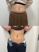 レアレア(Lea l'ea)/ヒブォーアフター