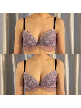 サロン ド ガーネット(Salon de Garnet)/初回１回目の施術でもこの効果☆