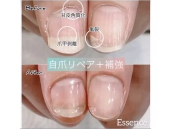 エッセンス (Essence)/爪甲剥離,亀裂の保護,補強リペア