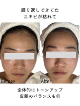 リヴィア(LIVIA)/テカリ・脂性肌にも