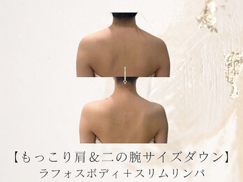 アネラボーテ(Anela Beaute)/ラフォス+スリムリンパ 3回目