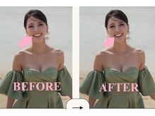 ホワイトニングショップ北四番丁店【4月中旬 NEW OPEN（予定）】/笑顔に自信が持てるように