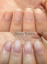マリーロール 梅田店(Marie Laure)/深爪矯正/自爪育成/自爪風