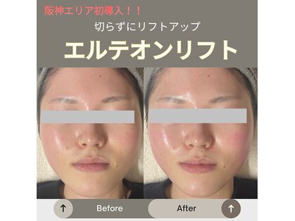 ココ ル メアリー アシヤ(COCO LE MARY ASHIYA)の写真