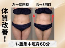 イヨヨ(iyoyo)/【痩身】Before After