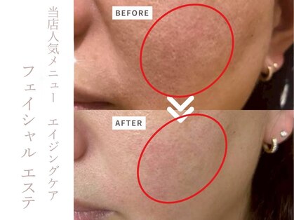 グリーン(green)の写真