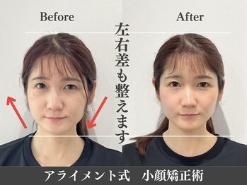 アライメント 自由が丘(Alignment)/左右差改善♪