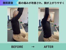 トミーリハ整体院(TOMMY REHA整体院)/長年治癒しなかった症状が改善！