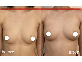 IBC 横浜馬車道店/デコルテ削げが気になる方にも♪