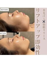 マヴィ 守口店(MavY.)/お顔軽くなります！