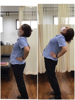 くすの樹接骨院 整体院 鳥栖院/整体/骨盤矯正ビフォーアフター