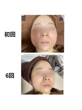 ヴィヴィエ 佐賀店(ViVier)/ララピール