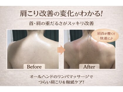 ローゼプランテ 小杉店の写真