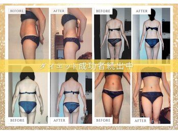 キレイサローネ 表参道店(KIREI SALONE)/ダイエット成功！[表参道]