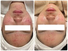 ビズビズ(bisebise)/