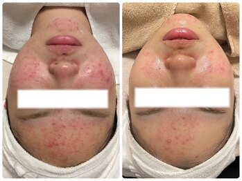 ビズビズ(bisebise)/