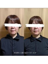 ヨサパーク ケイアンドリー(YOSA PARK)/ハイディーナ×ルルオン