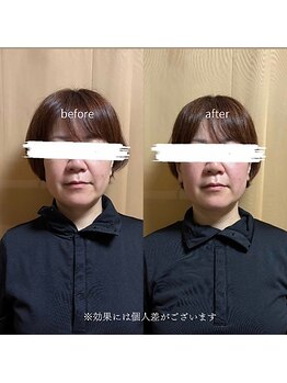 ヨサパーク ケイアンドリー(YOSA PARK)/ハイディーナ×ルルオン