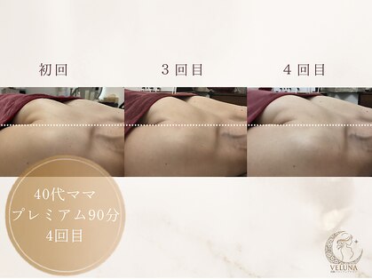 ヴェルナ(VELUNA)の写真