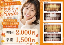 ホワイトニングショップ 川越店