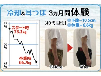 ラフィール/耳介・冷却　３ヶ月　男性40代