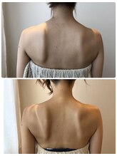 エイシスグロウ(asis glow.)/効果写真