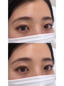 アイビューティートロント(i beauty Toronto)/パリジェンヌラッシュリフト