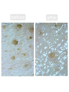 トランク(Trunk)/ハイドラ♪before→after