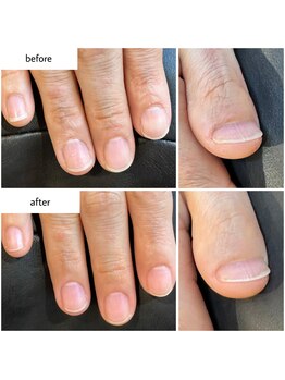 ケアプラス(care plus)/ハンドネイルケア