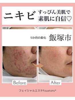 フワットン(Fouatons)/