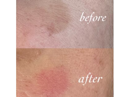 ハナスイ(HANASUI)の写真