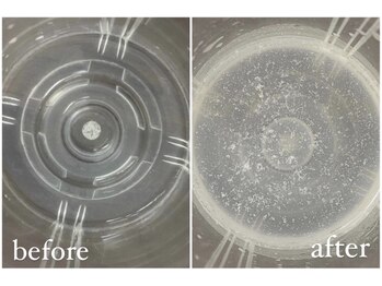 ローズ(Rose)/before after