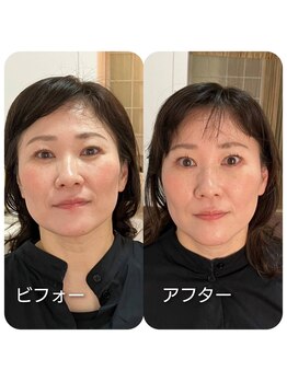 呼吸の音/血流改善でお顔もスッキリ!