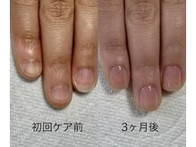 ネイルサロンアンドスクール マルベリー(mulberry)の雰囲気（「爪の形綺麗だね！」と言われるようになりこの変化がうれしい♪）