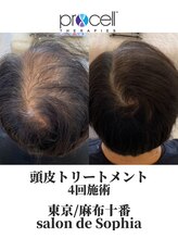 サロンドソフィア 麻布十番(salon de Sophia)/プロセルセラピーズ頭皮ケア