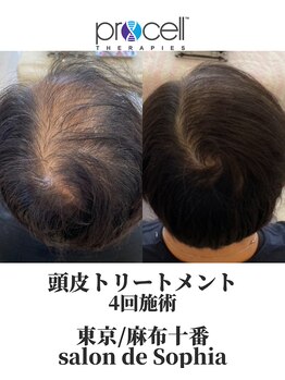 サロンドソフィア 麻布十番(salon de Sophia)/プロセルセラピーズ頭皮ケア