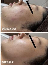 ココサロン(Coco Salon)/ホームケア用品★