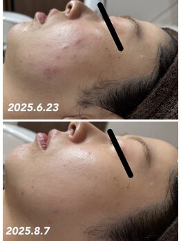 ココサロン(Coco Salon)/ホームケア用品★
