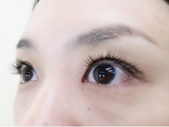 アビオ 戸田店(ABIO)/施術後★after