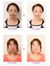 《お顔の筋肉を１つずつ鍛え小顔効果・たるみ改善に！》ボワールリフティング
