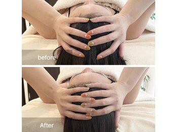 オルネ(ORNE.)/《リセットヘッドセラピー》