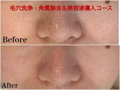 ちゅるん肌ドットコム 梅田店(ちゅるん肌.com)の写真